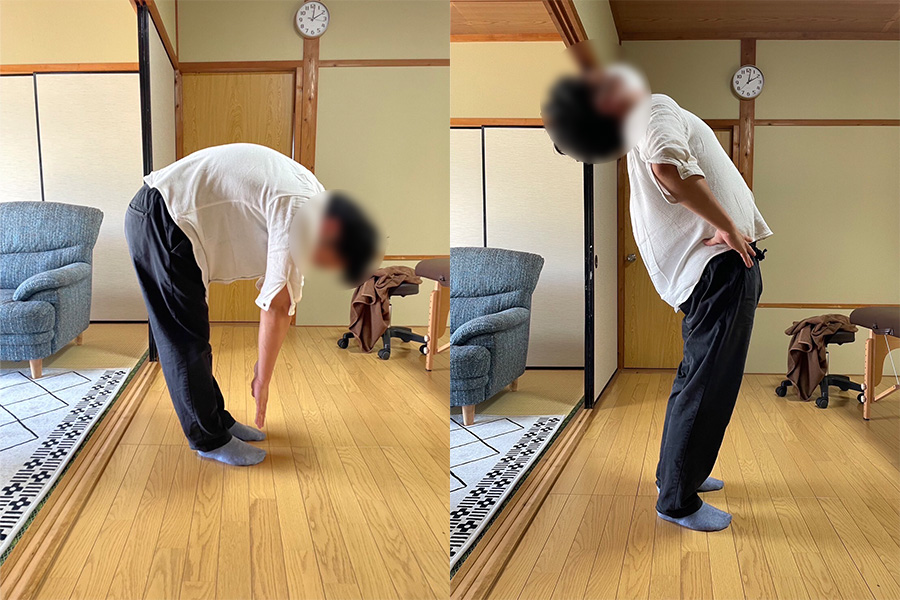 施術例2