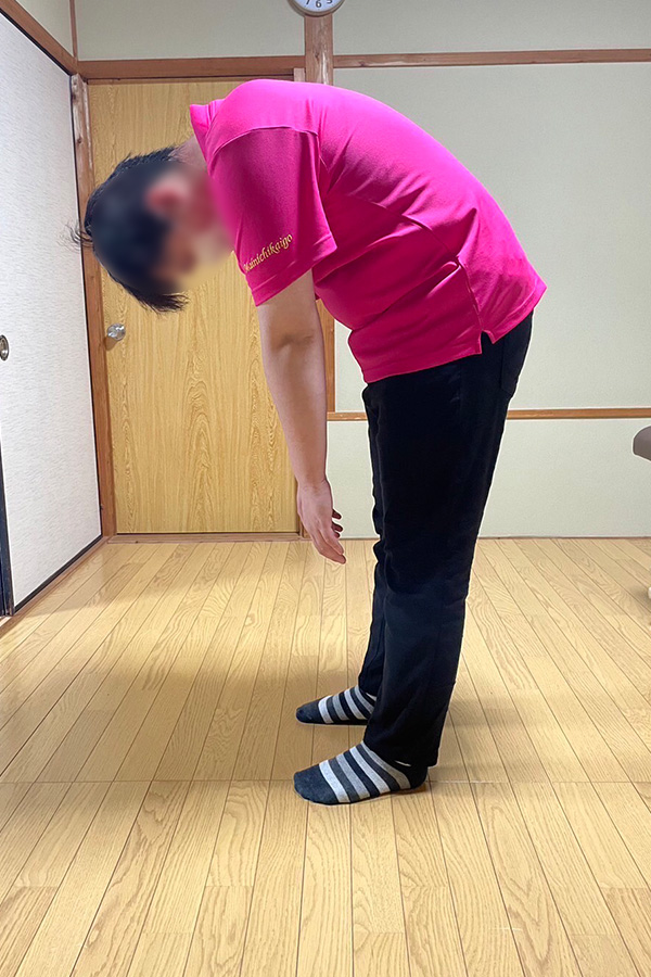 施術例3