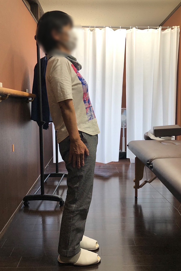施術例7
